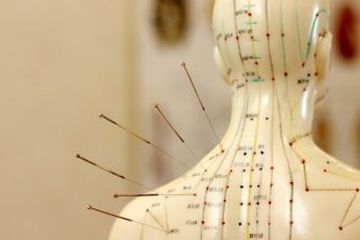 acupuncture-1-368x220jpg-20220629035109